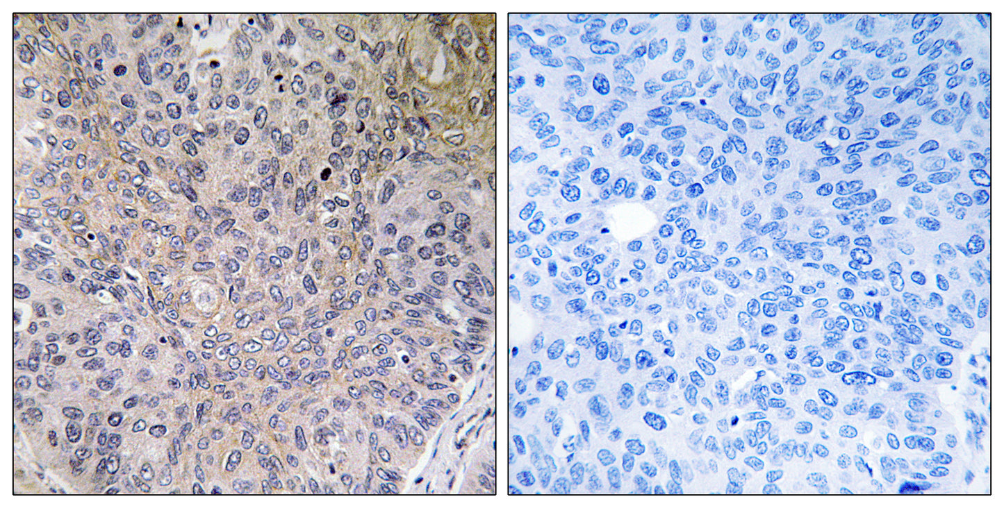 NDUFS7 Rabbit Polyclonal Antibody