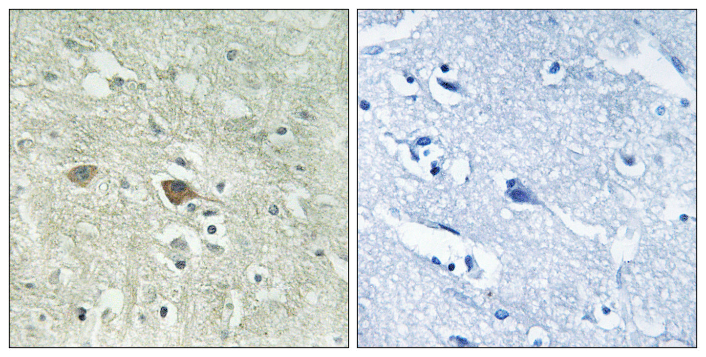 NDUFV3 Rabbit Polyclonal Antibody