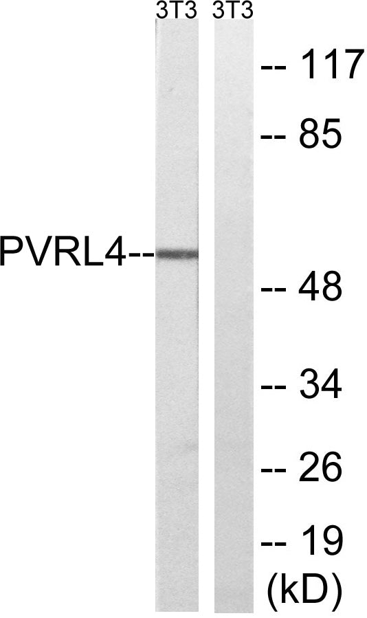 Nectin 4 Rabbit Polyclonal Antibody
