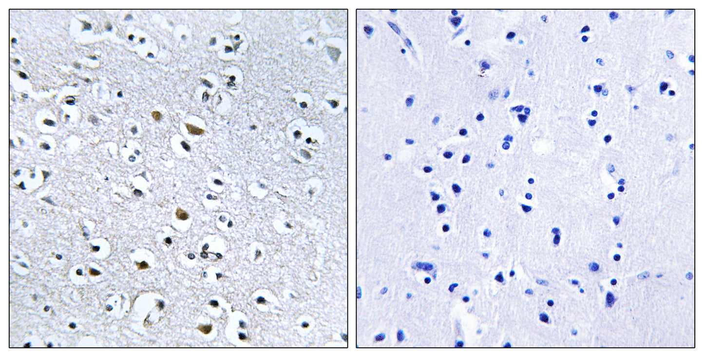 Nephrocystin-4 Rabbit Polyclonal Antibody