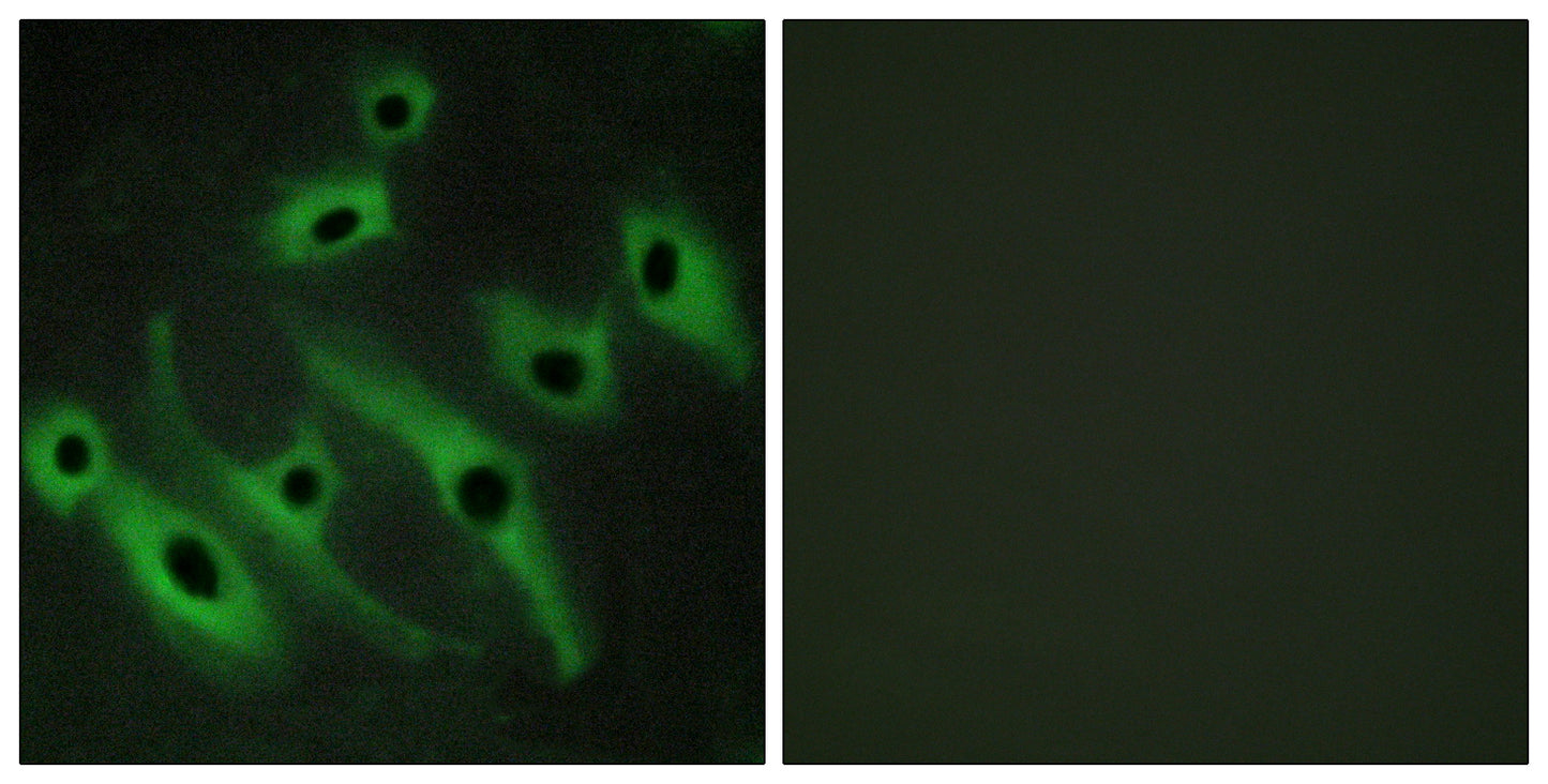 Neu Rabbit Polyclonal Antibody