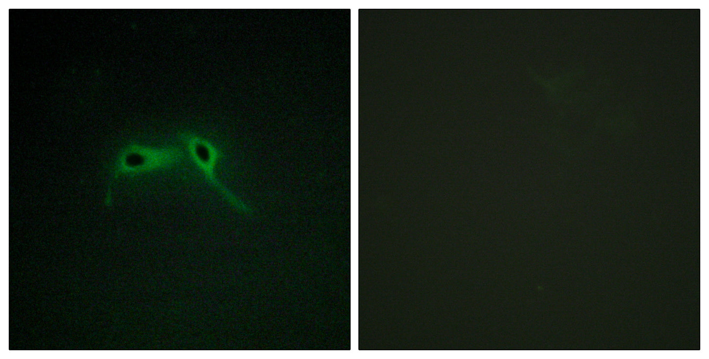 Neurofibromin Rabbit Polyclonal Antibody