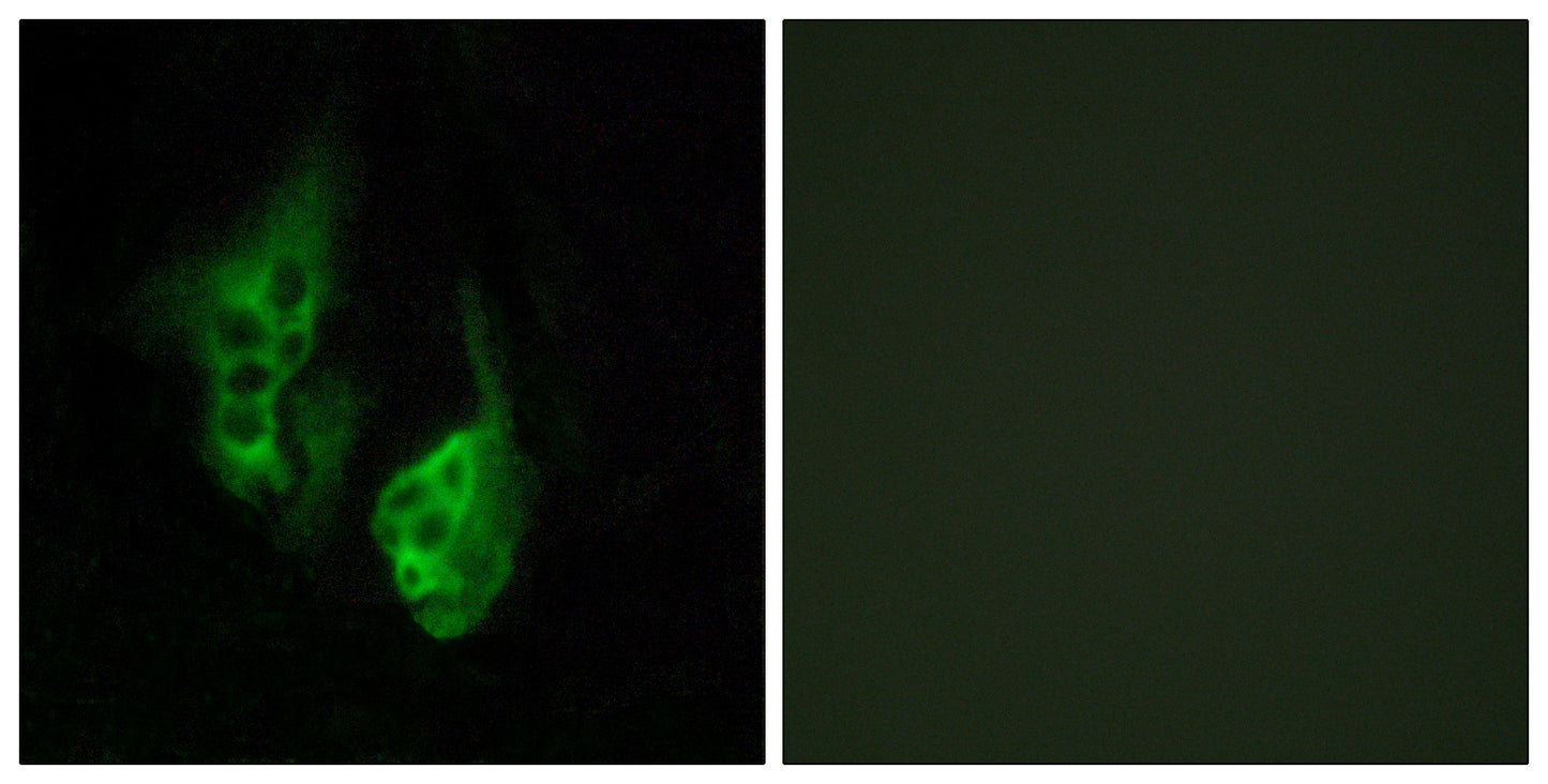 Neuropsin Rabbit Polyclonal Antibody