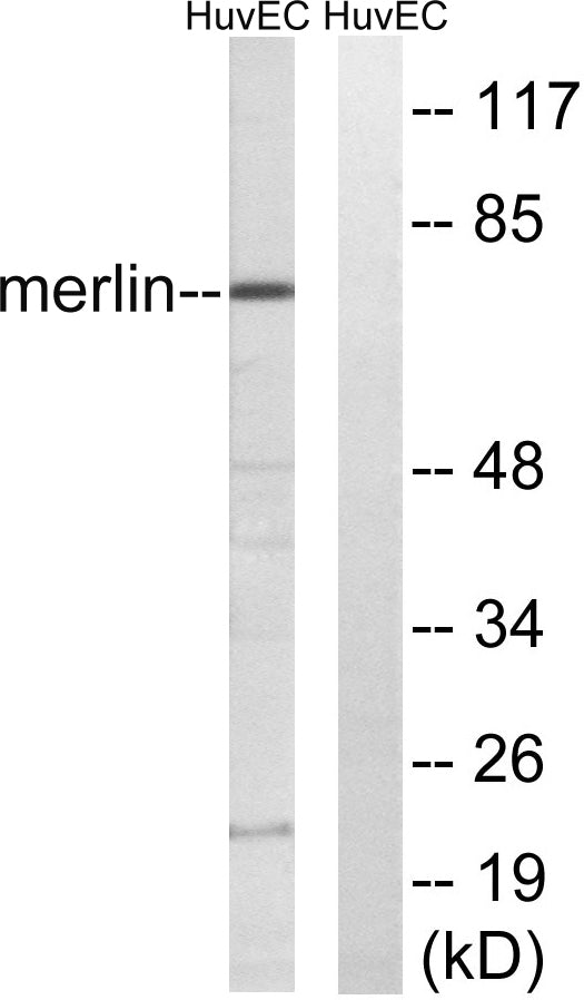 NF2 Rabbit Polyclonal Antibody