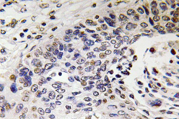NF-H Rabbit Polyclonal Antibody