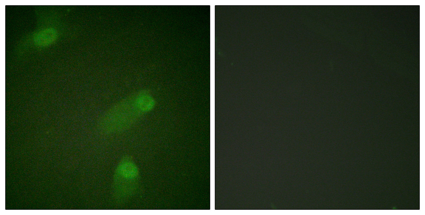 NFκB-p105 Rabbit Polyclonal Antibody