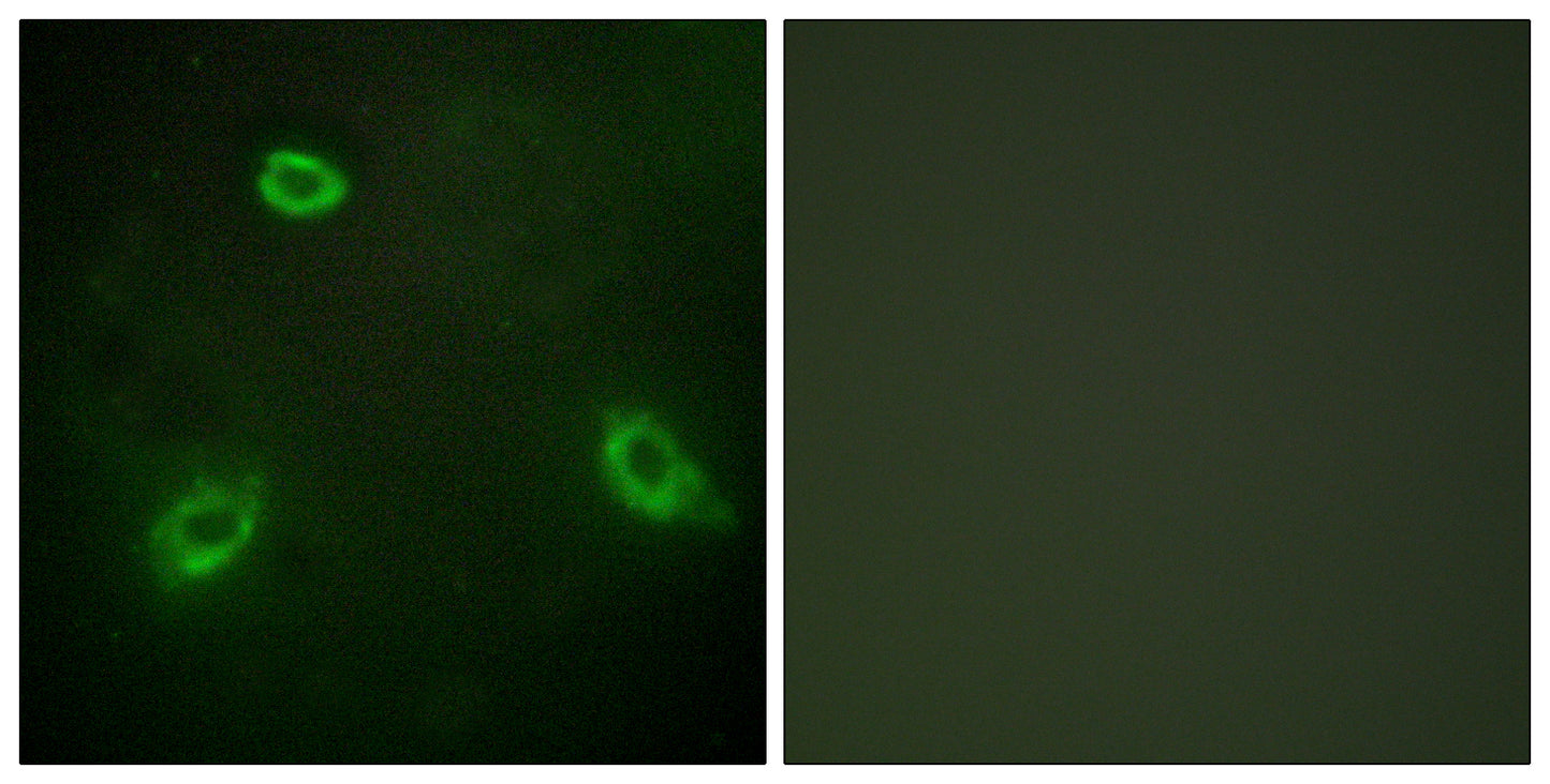 NGEP Rabbit Polyclonal Antibody