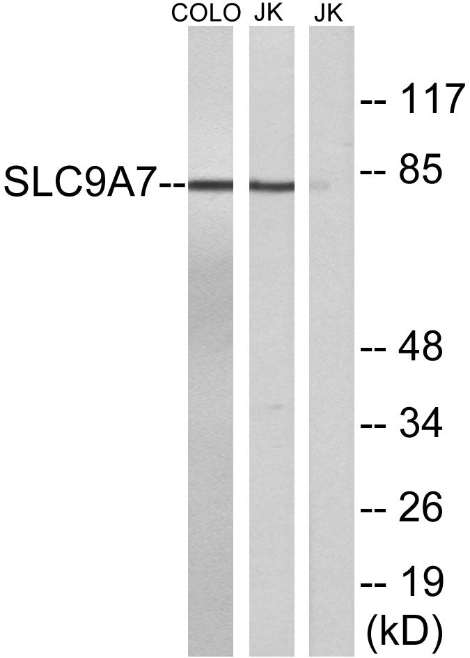 NHE-7 Rabbit Polyclonal Antibody