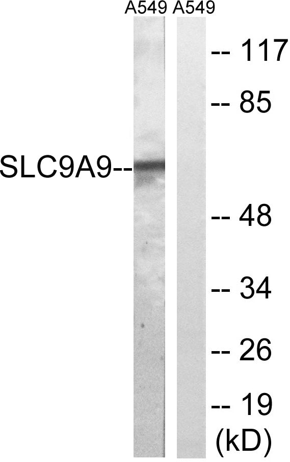 NHE-9 Rabbit Polyclonal Antibody
