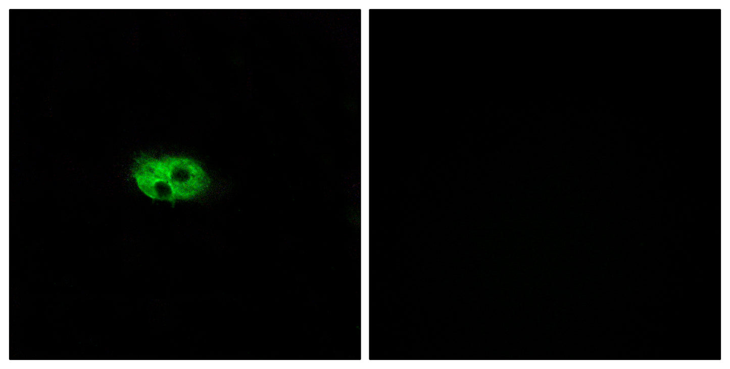 NK-3R Rabbit Polyclonal Antibody