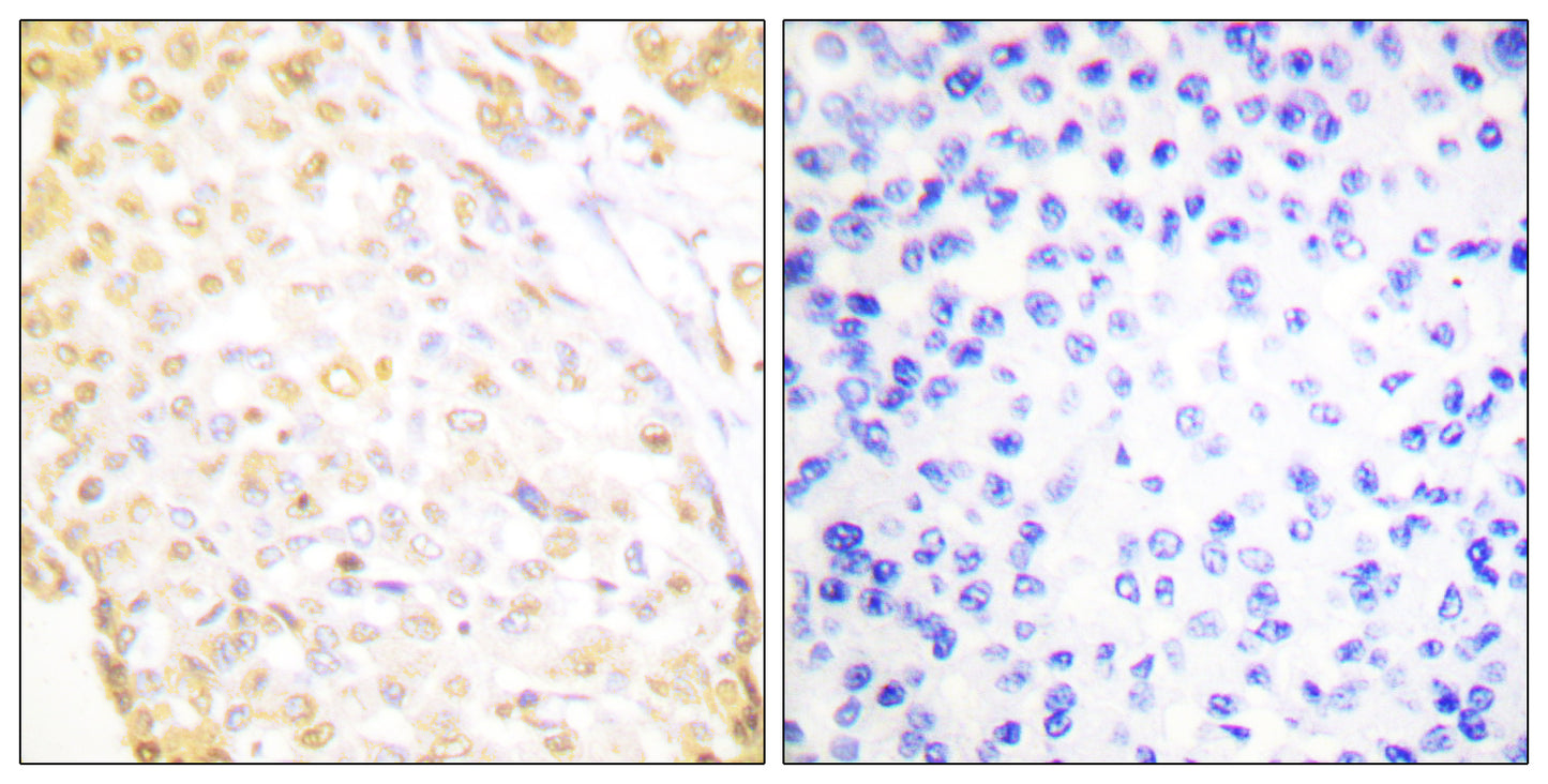 Nkx-3.1 Rabbit Polyclonal Antibody
