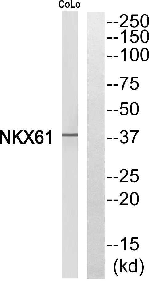 Nkx-6.1 Rabbit Polyclonal Antibody