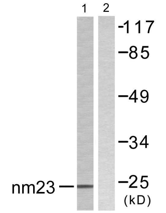 NM23-H2 Rabbit Polyclonal Antibody