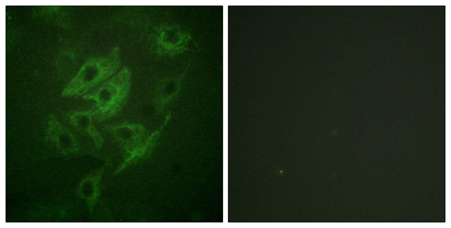 NMDAε1/2 Rabbit Polyclonal Antibody