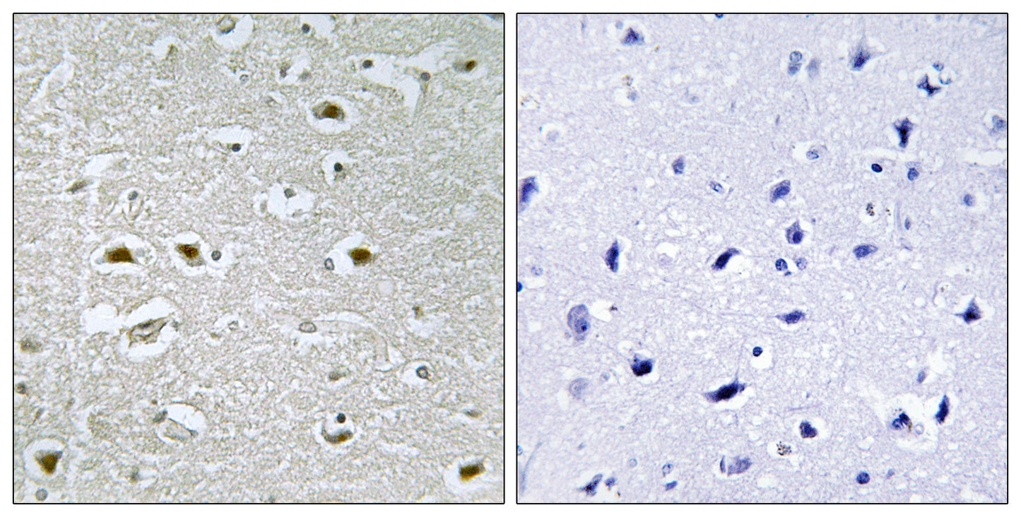 NPA1 Rabbit Polyclonal Antibody