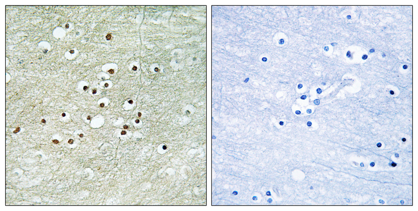 NPAS4 Rabbit Polyclonal Antibody