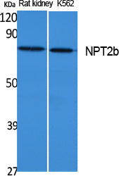 NPT2b Rabbit Polyclonal Antibody