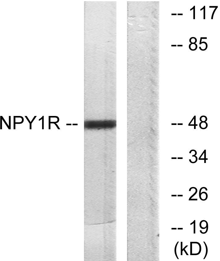 NPY1-R Rabbit Polyclonal Antibody