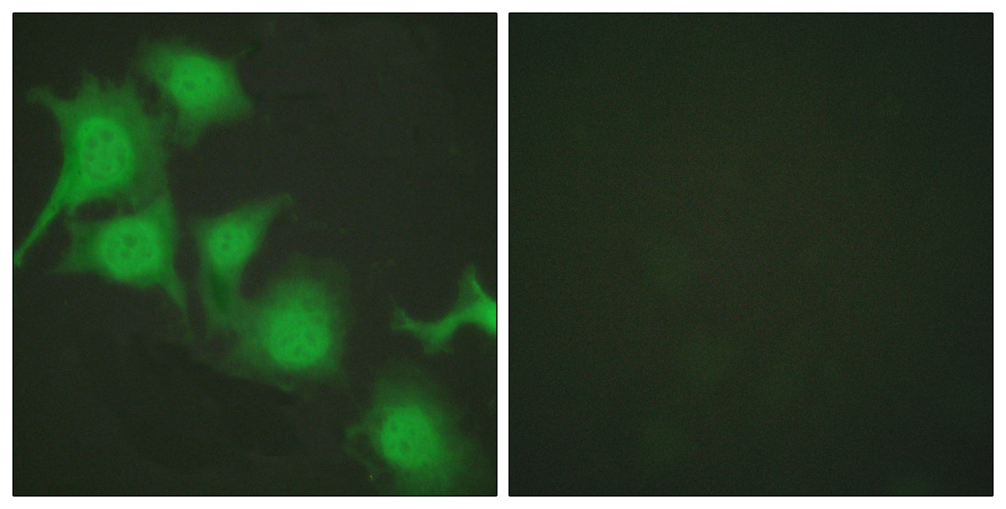 Nrf2 Rabbit Polyclonal Antibody