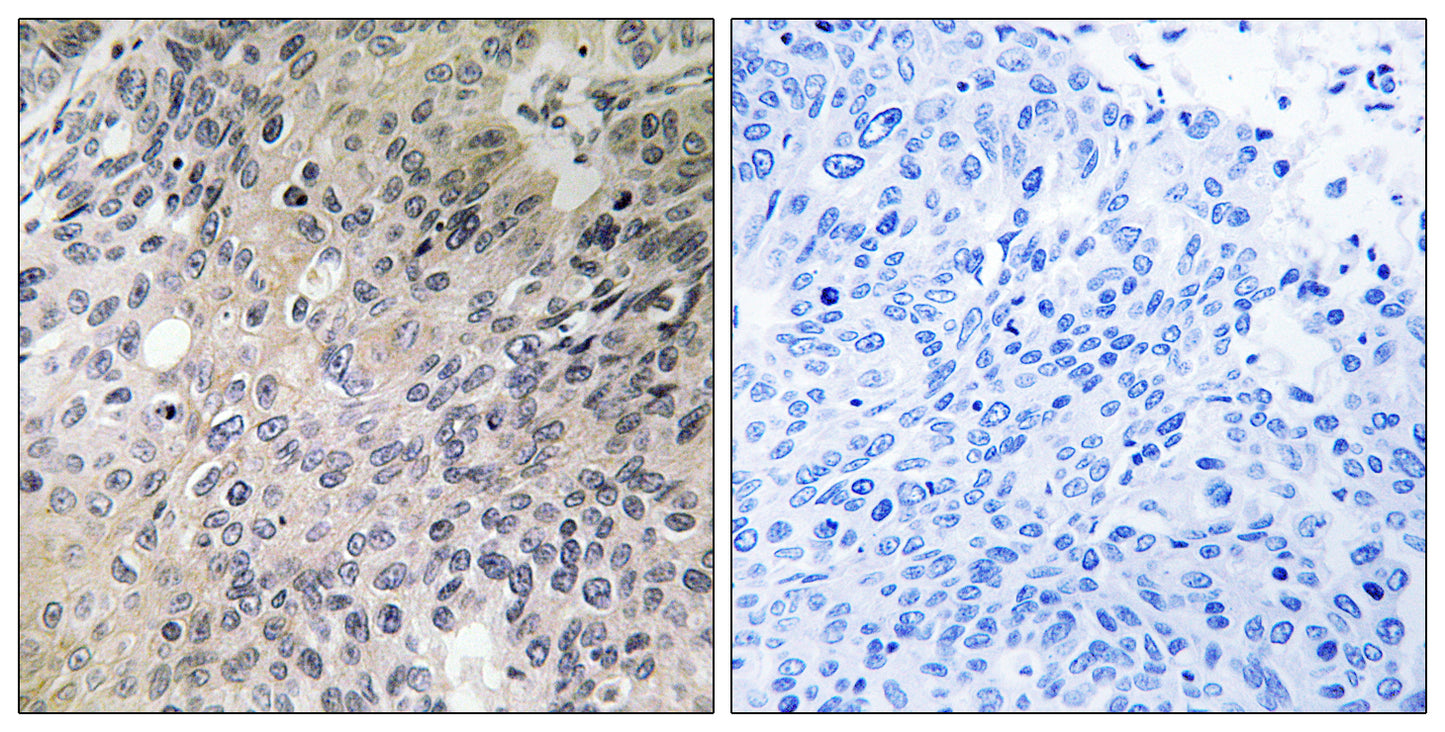 N-Shc Rabbit Polyclonal Antibody