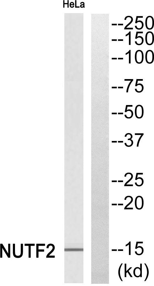 NTF2 Rabbit Polyclonal Antibody