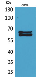 NUMB Rabbit Polyclonal Antibody