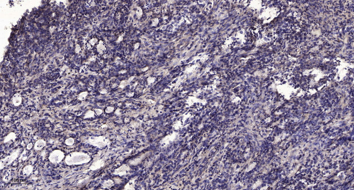 NY-CO-8 Rabbit Polyclonal Antibody