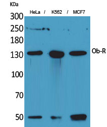 Ob-R Rabbit Polyclonal Antibody