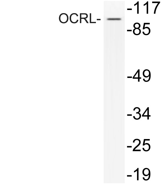 OCRL Rabbit Polyclonal Antibody