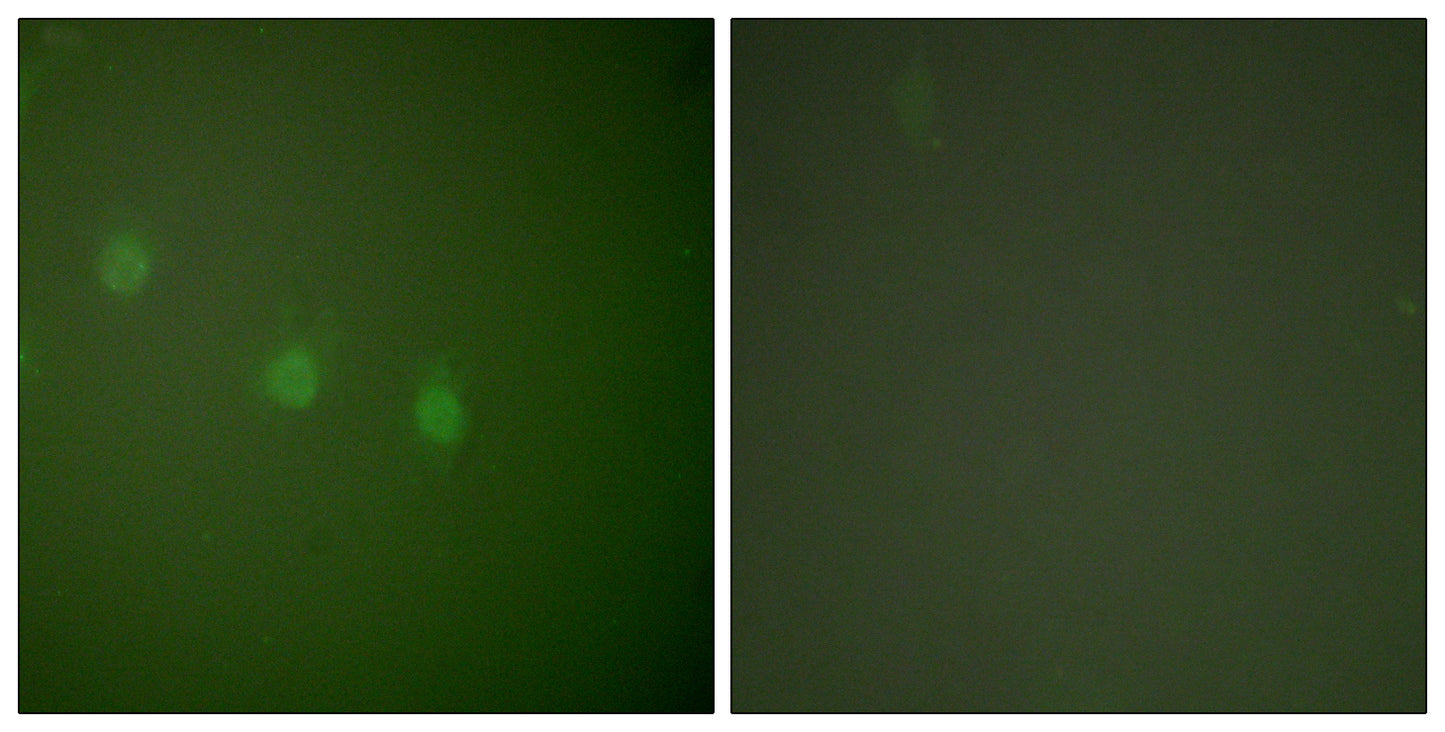 Oct-2 Rabbit Polyclonal Antibody