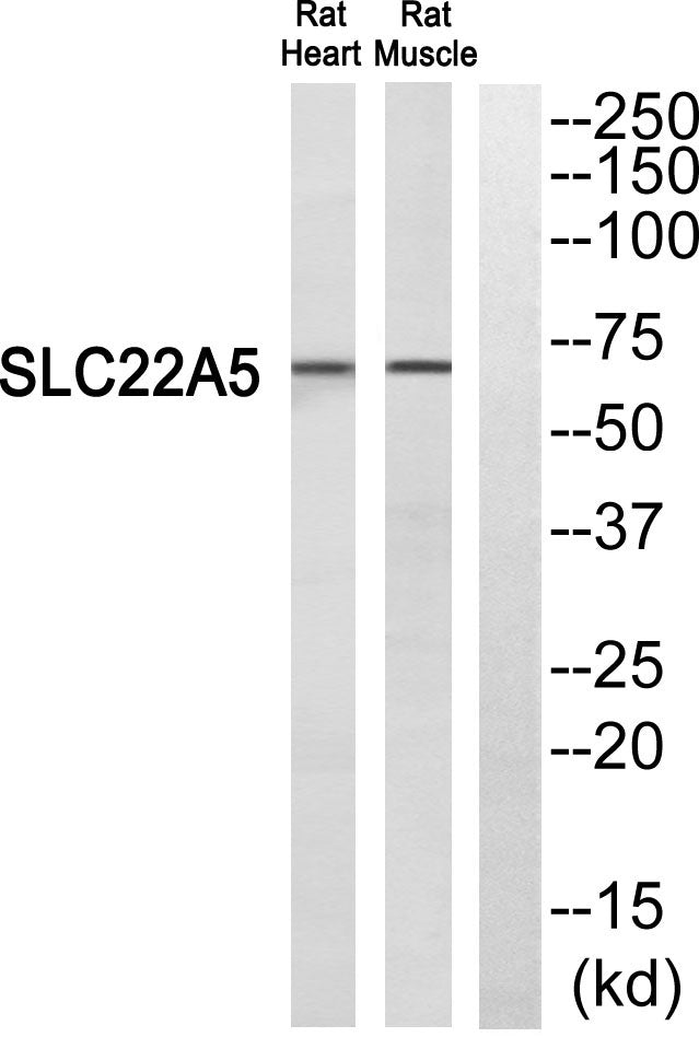 OCTN2 Rabbit Polyclonal Antibody