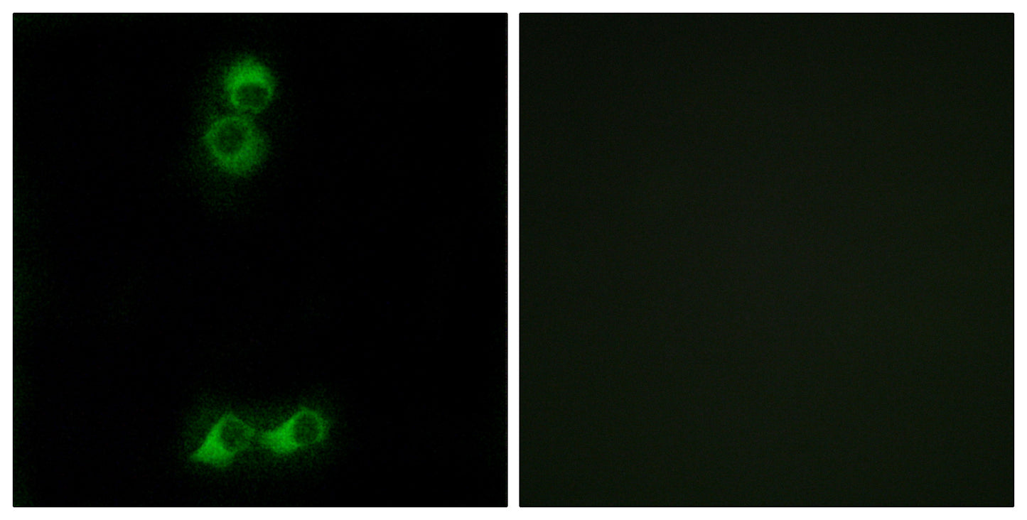 Olfactory receptor 10J5 Rabbit Polyclonal Antibody
