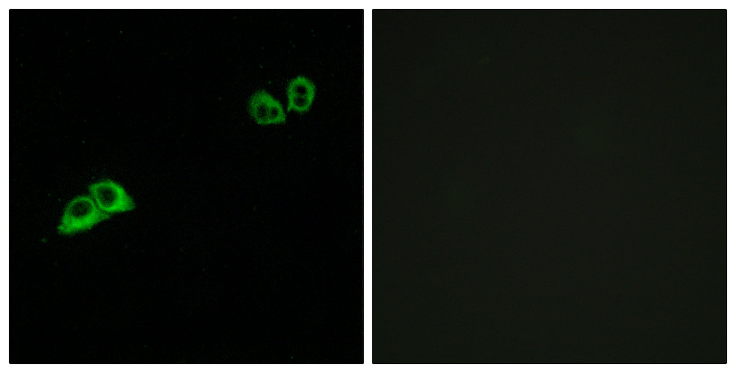 Olfactory receptor 2AT4 Rabbit Polyclonal Antibody