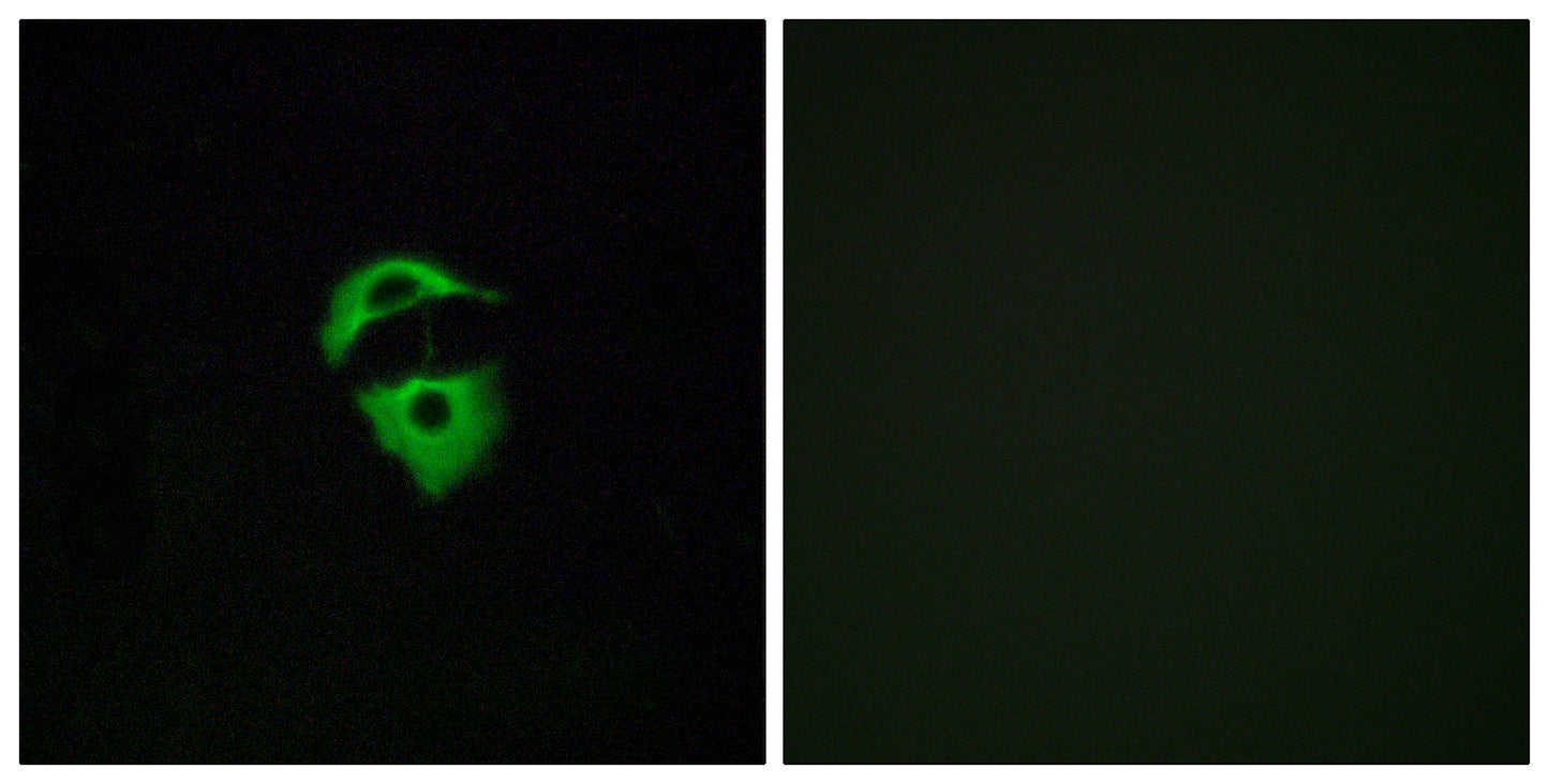 Olfactory receptor 2D2 Rabbit Polyclonal Antibody