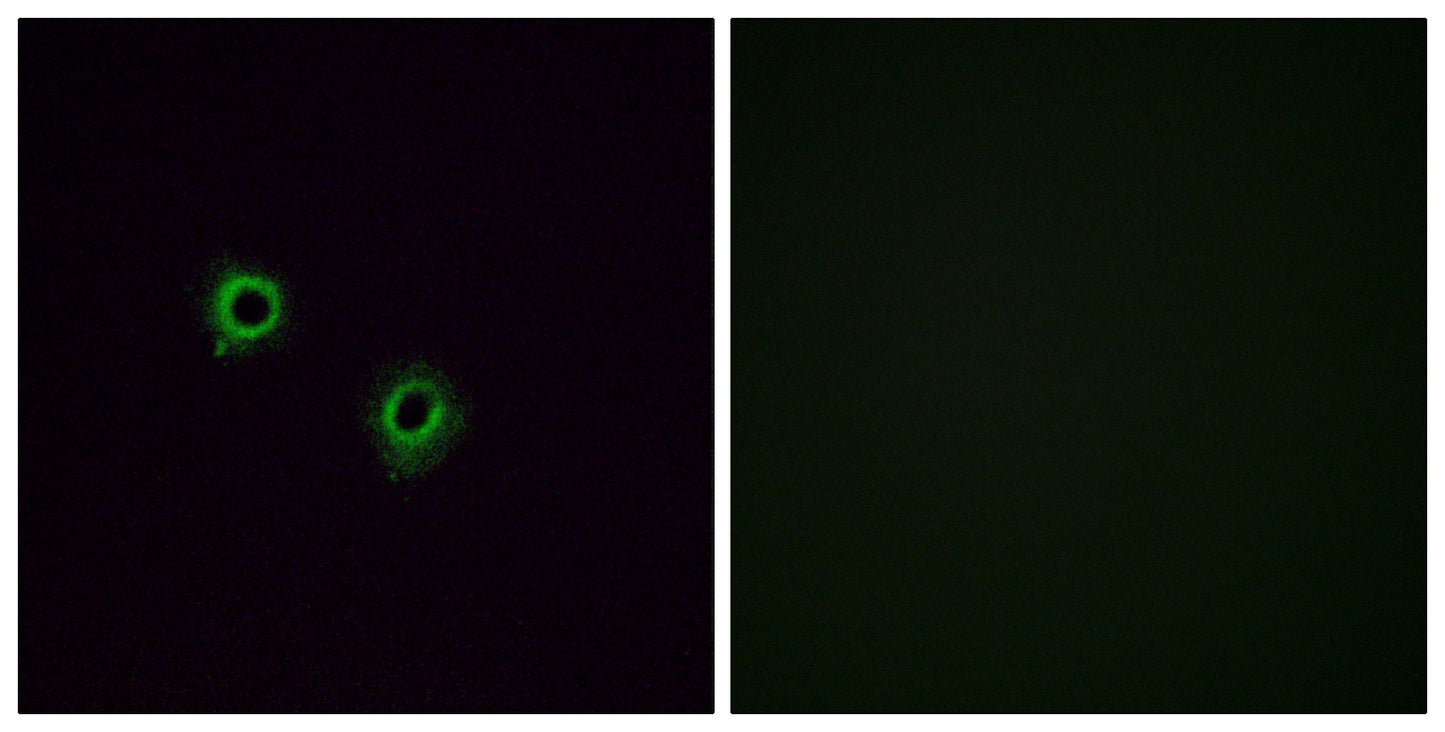 Olfactory receptor 2J3 Rabbit Polyclonal Antibody