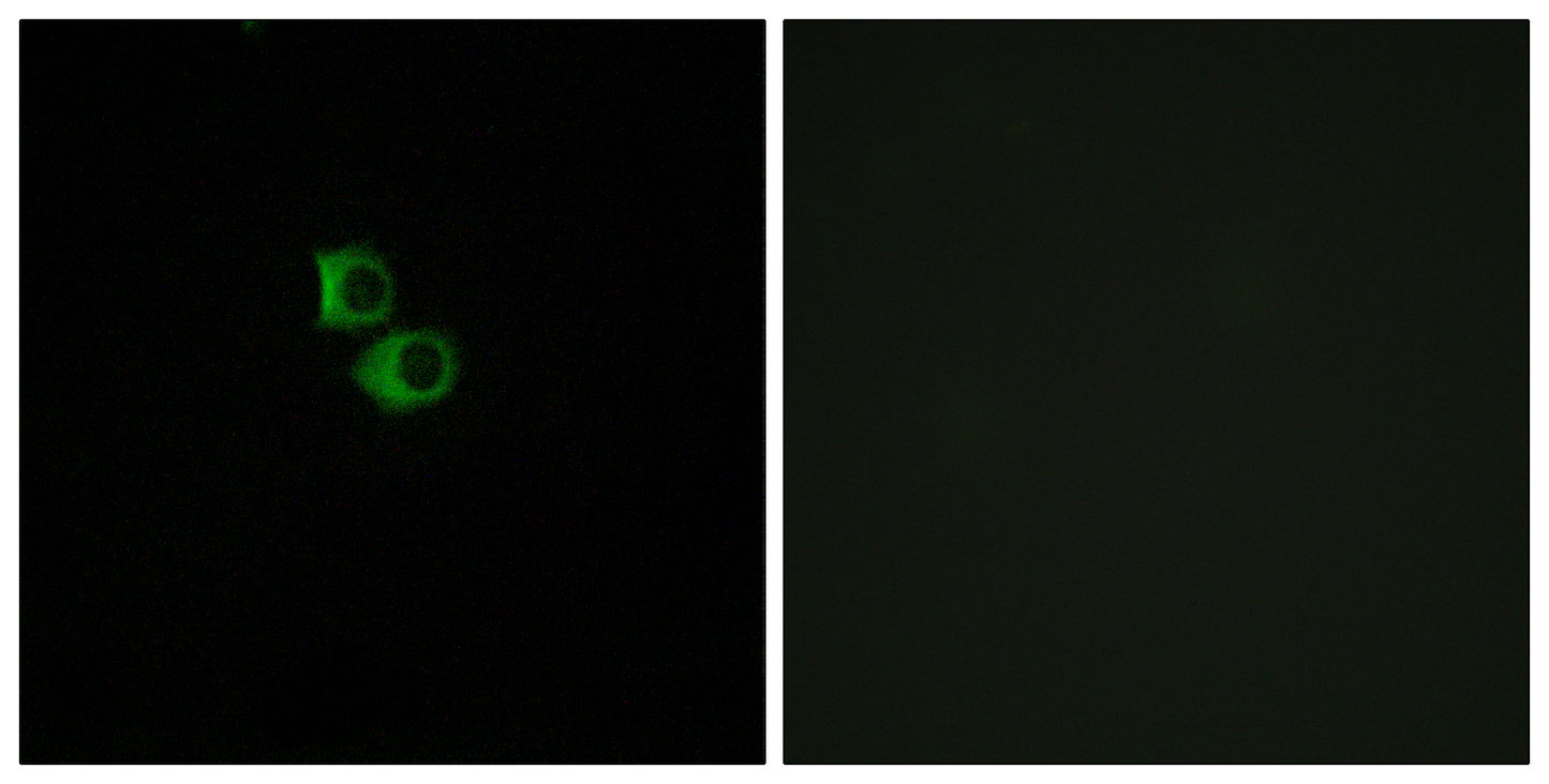 Olfactory receptor 51B6 Rabbit Polyclonal Antibody