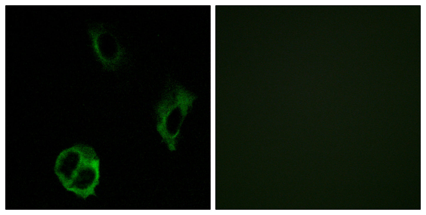 Olfactory receptor 51I1 Rabbit Polyclonal Antibody