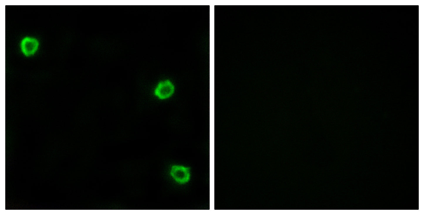 Olfactory receptor 51Q1 Rabbit Polyclonal Antibody