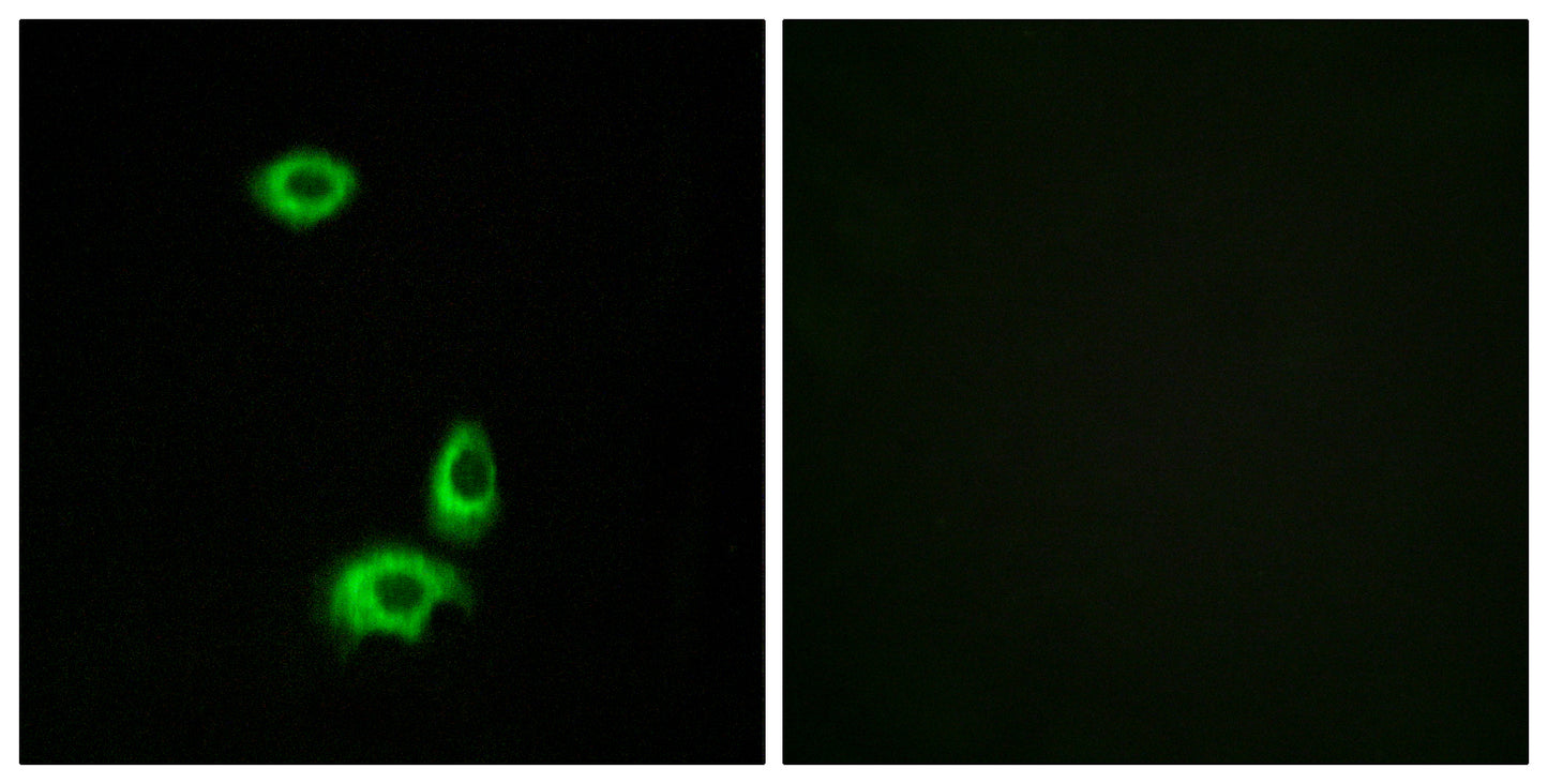 Olfactory receptor 56B1 Rabbit Polyclonal Antibody