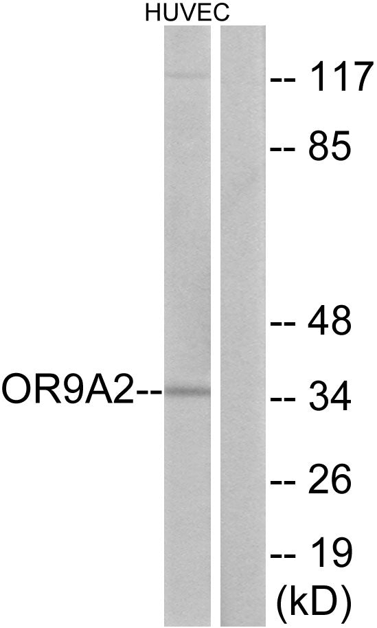 Olfactory receptor 9A2 Rabbit Polyclonal Antibody