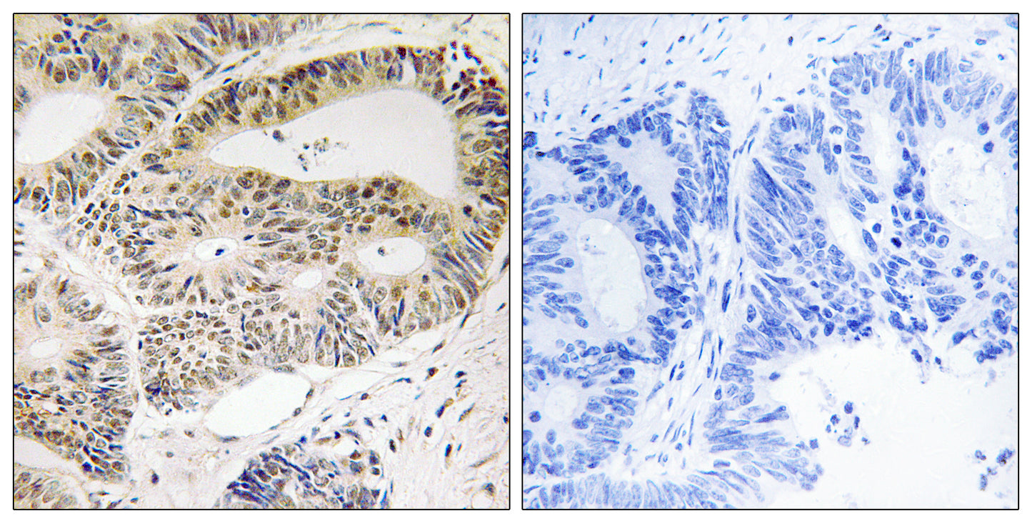 OSR1 Rabbit Polyclonal Antibody