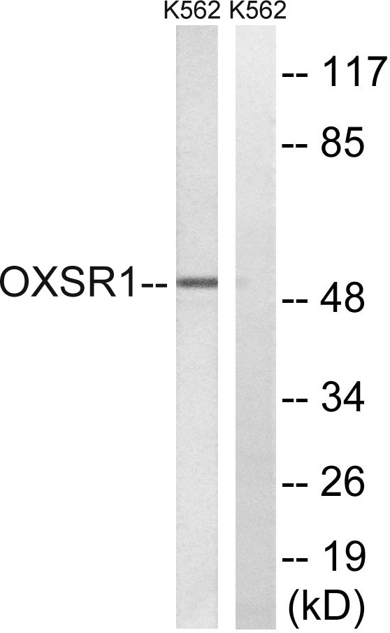 OXSR1 Rabbit Polyclonal Antibody