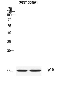 p16 Rabbit Polyclonal Antibody