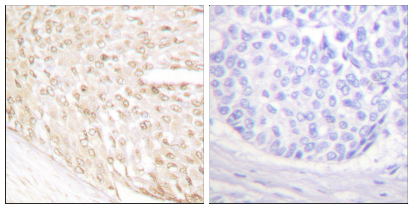 p18 Rabbit Polyclonal Antibody