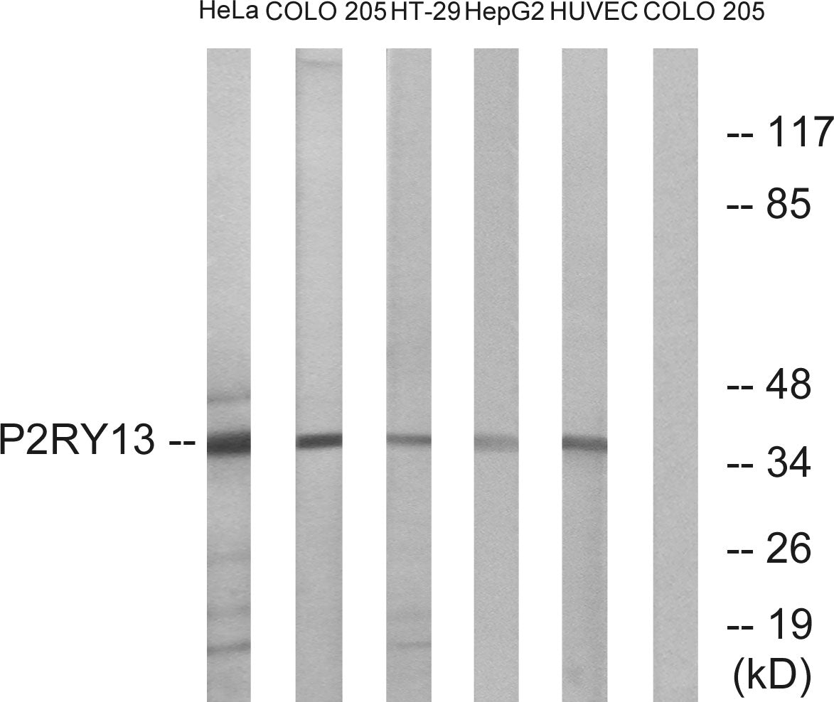 P2RY13 Rabbit Polyclonal Antibody