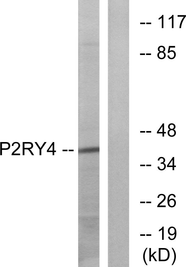 P2Y4 Rabbit Polyclonal Antibody