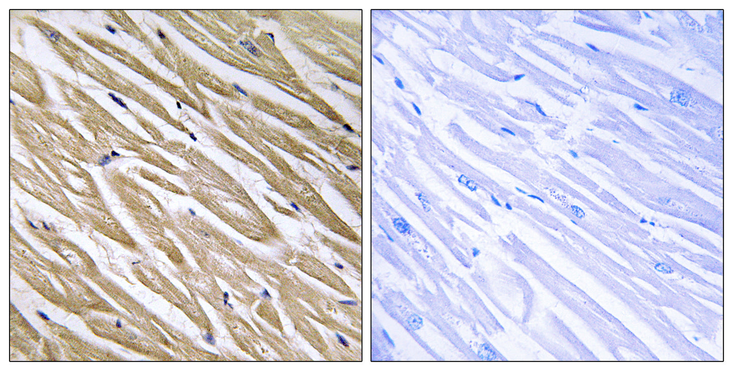 P311 Rabbit Polyclonal Antibody
