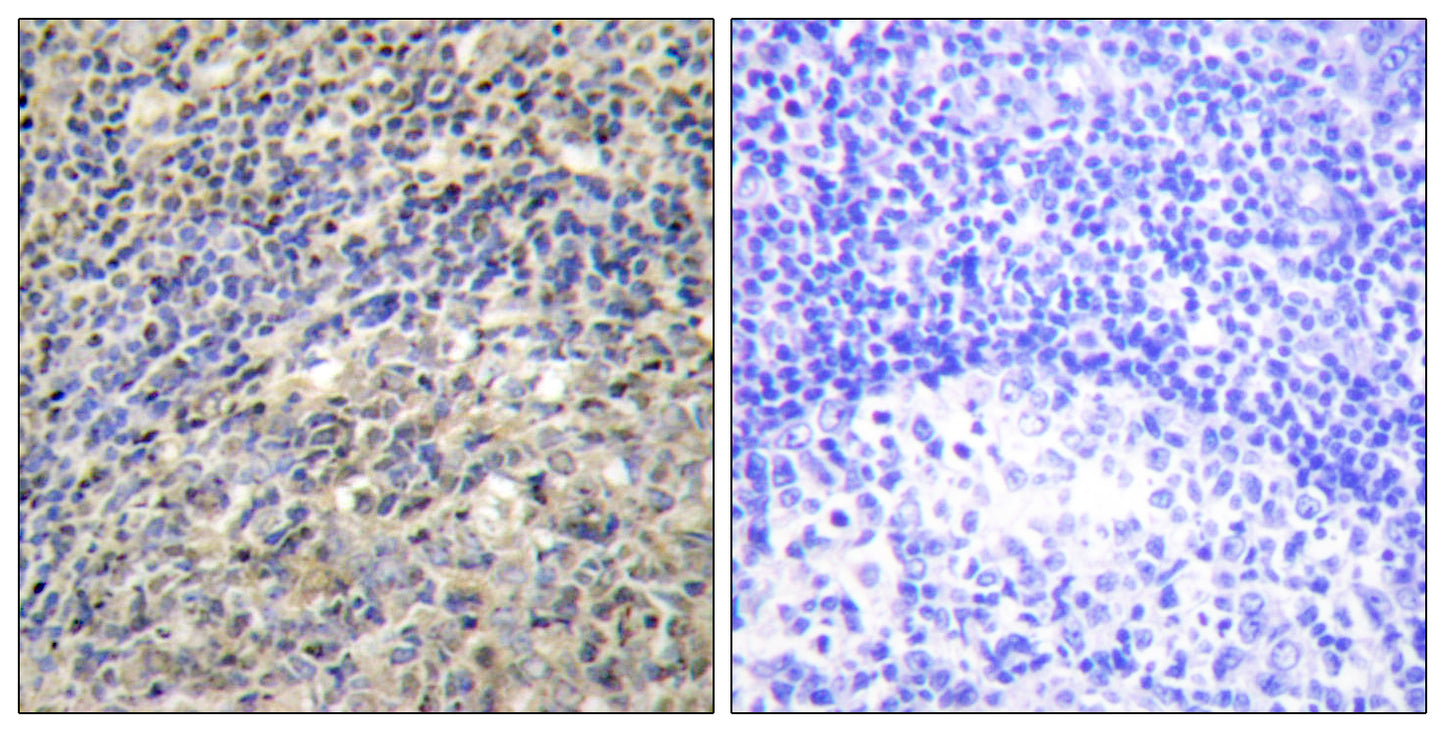 p47-phox Rabbit Polyclonal Antibody