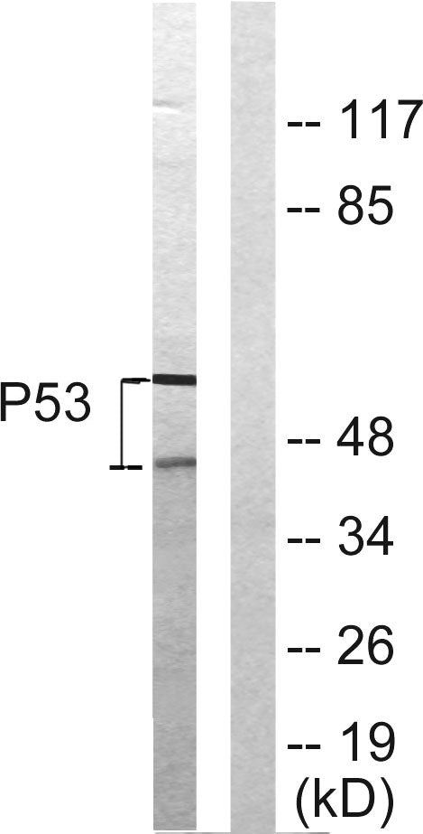 p53 Rabbit Polyclonal Antibody