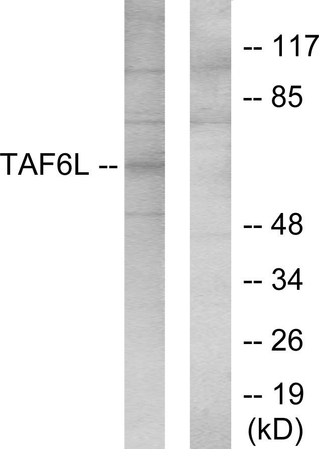 PAF65α Rabbit Polyclonal Antibody